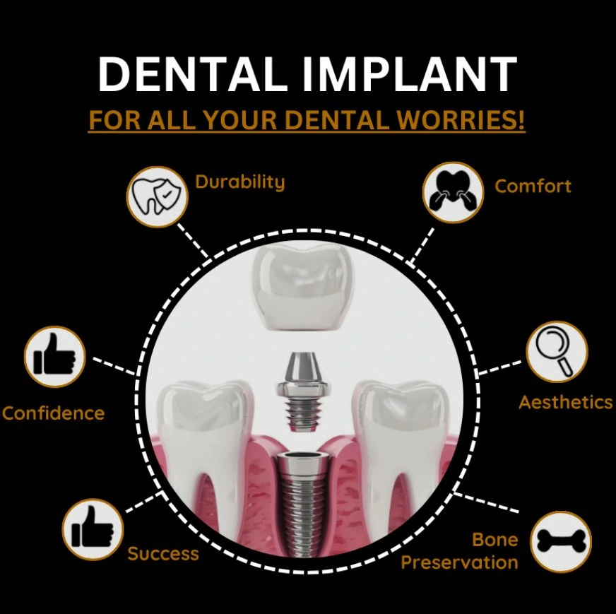 Benefits of dental implant